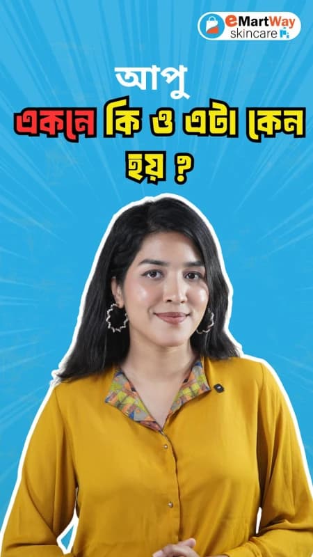 What is Acne??