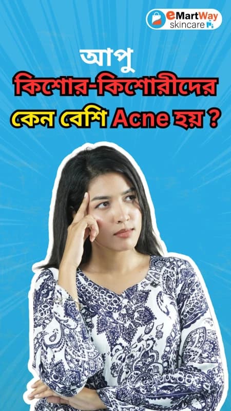 Why do Teenagers have Acnes??