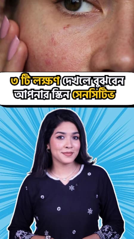 3 Syntoms for Sensitive Skin